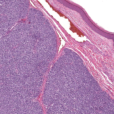 https://www.pathology.med.umich.edu/static/apps/cms/700/slide-10-22-18.jpg