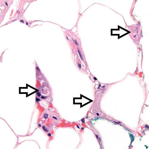 https://www.pathology.med.umich.edu/static/apps/cms/832/McMullen_sq.jpg