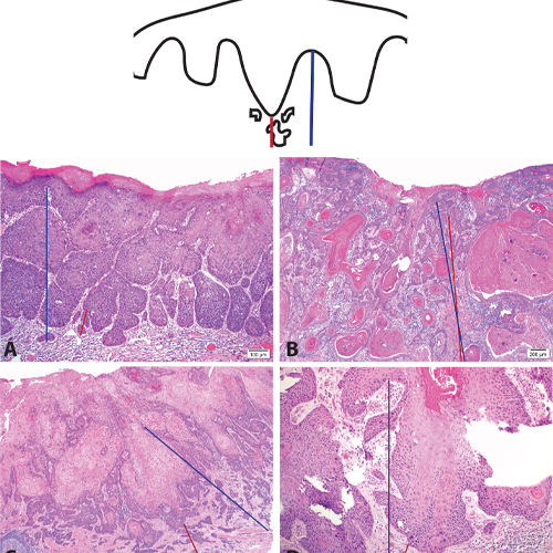 https://www.pathology.med.umich.edu/static/apps/cms/997/Skala_Story_500x500px.jpg