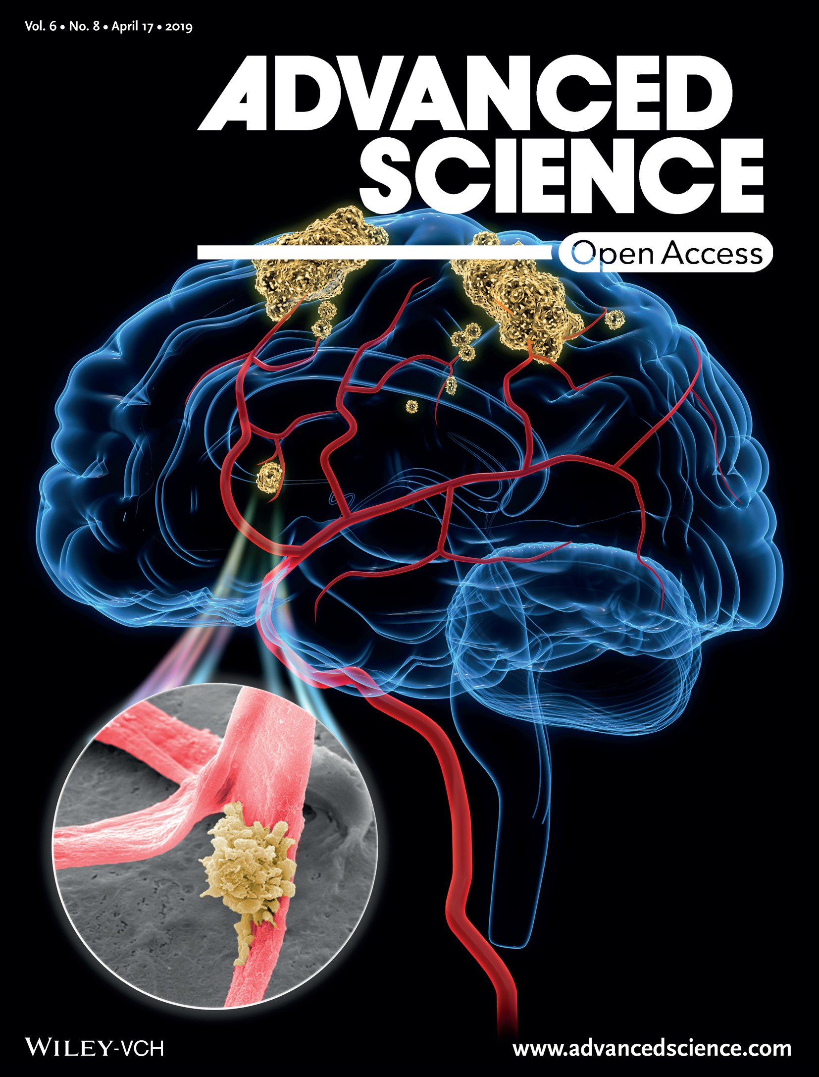 Brain tumor cells hijacking the blood vessels as highway.