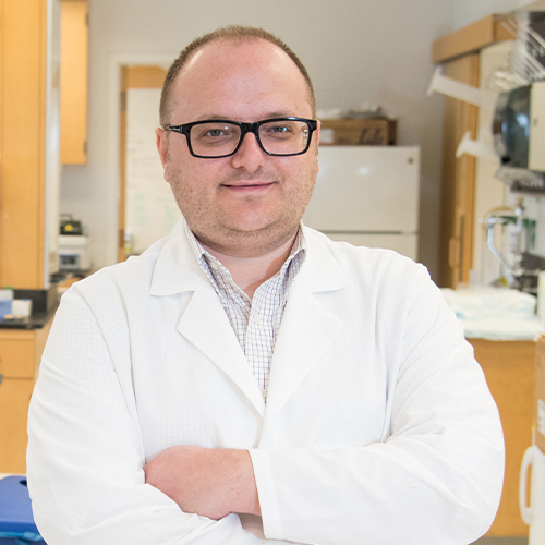 New Assay For Early Detection of Aggressive Prostate Cancers Developed