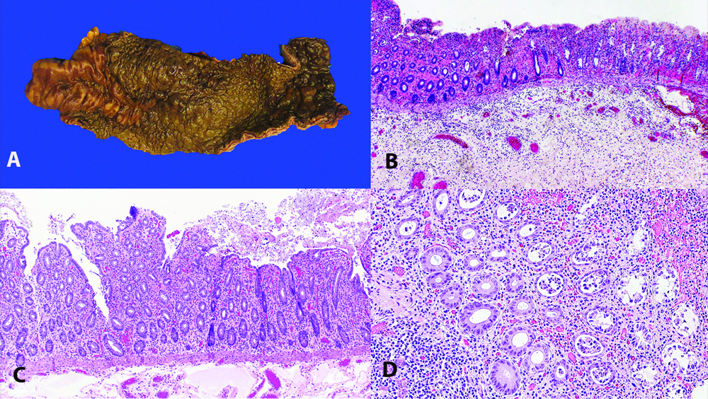 Biopsy figures.