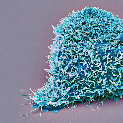 /static/apps/cms/news/1147/Blue-Kidney-Cancer-Cell-500x500.jpg