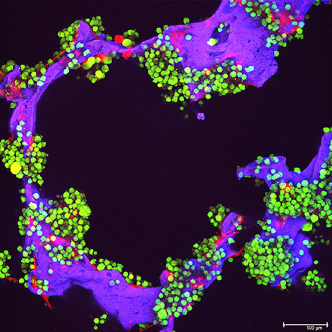 Researchers Find Link Between Genetic Mutations and Cancer Treatment Resistance