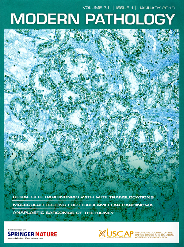 Modern Pathology Jan2018 | Rohit Mehra and Steph Skala