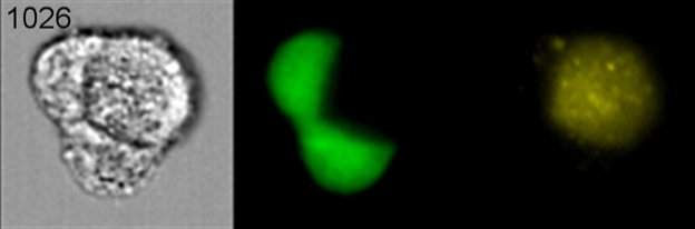 2 representative flow cytometry Live Imaging Stream pictures of MDA-MB-231 breast cancer cell labeled with fluorescence  GFP,  engulfing MSC ( Mesenchymal Stem Cell labeled with fluorescence Ds-Red. 