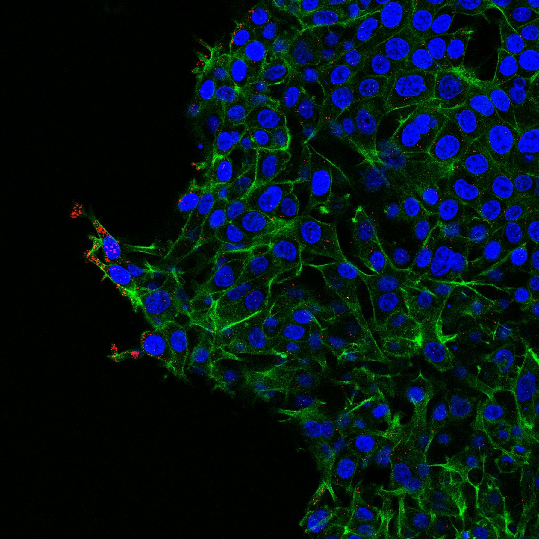 Resolvin E1 promotes intestinal epithelial cell wound healing by increasing Rac1 activity (red dots) at the leading edge of migration (cytoskeleton in green). 