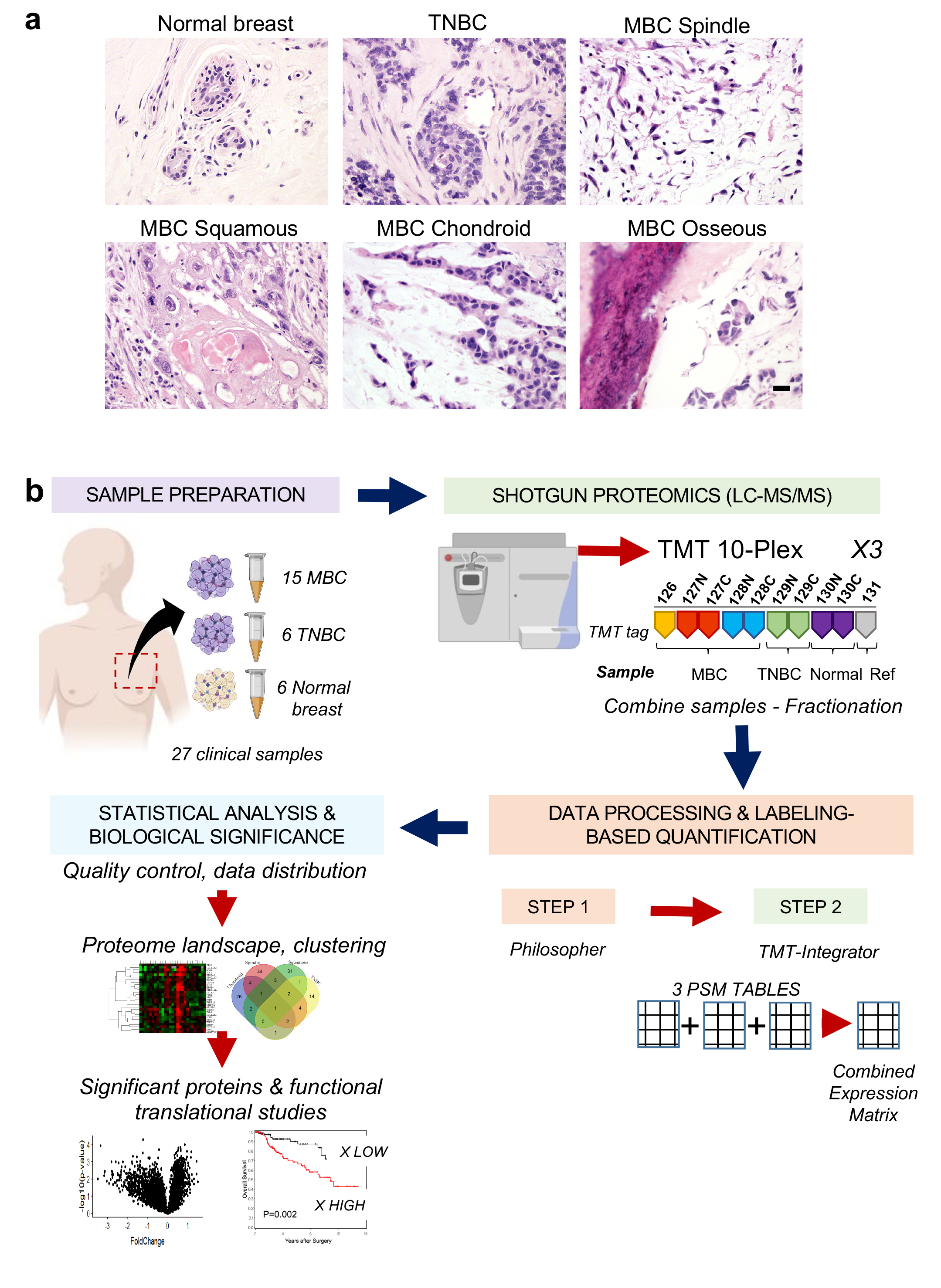 Clinicopathological features of all clinical samples and summary of quantitative proteomics workflow. A) Representative histology images (H&E) and diagnoses on our patient cohort including normal breast, non-MBC triple-negative, and each metaplastic subtype (spindle, squamous, sarcomatoid or mixed). Scale bar = xx μm. B) Quantitative mass spectrometry profiling workflow using a total of 27 clinical tissue samples for LC-MS/MS tandem mass tag (TMT) isobaric labeling and two novel pipelines of computational methods. Philosopher was used for label-free quantification and TMT-Integrator for filtering, PSM selection, normalization, and generation of a combined protein expression table for downstream statistical analyses. 